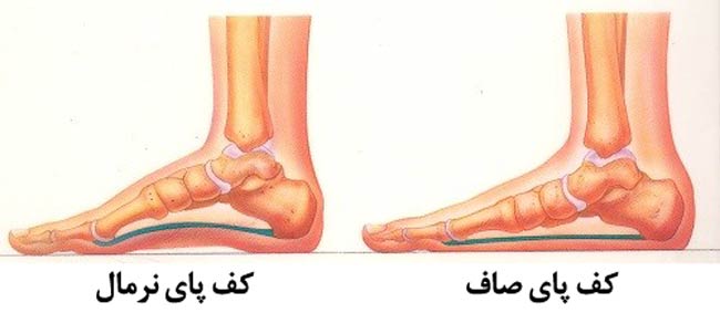 صافی و درد پای خود را با مراجعه به کلینیک دکتر میرپا برای همیشه حل کنید