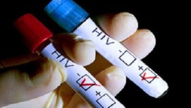 آخرین وضعیت HIV/AIDS در کشور